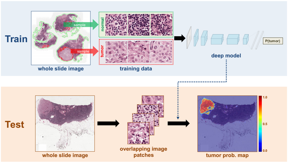 Artificial Intelligence's Role in Cancer Diagnosis 4 gorsel2 2